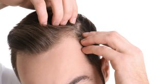 Best Hair Transplant Surgeon in Indore