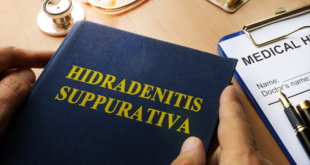 Hidradenitis Suppurativa Treatment