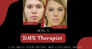 How-a-DMK-Therapist-Can-Treat-Your-Specific-Skin-Concerns-From-Acne-to-Aging