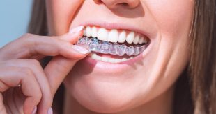 Invisalign Treatment