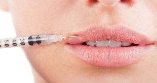 Lip Fillers in Dubai