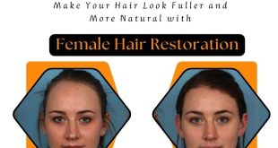 Make-Your-Hair-Look-Fuller-and-More-Natural-with-Female-Hair-Restoration