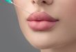 Russian Lip Fillers in Dubai