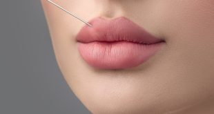 Russian Lip Fillers in Dubai