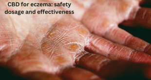 CBD for eczema: safety dosage and effectiveness