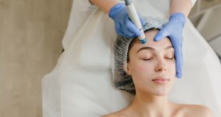 Microneedling Treatments: A Natural Way to Renew Skin.