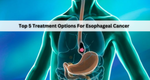 Top 5 Treatment Options For Esophageal Cancer