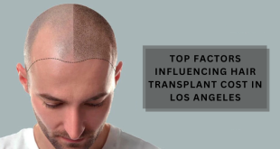 hair transplant los angeles cost