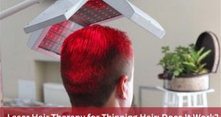 laser hair therapy