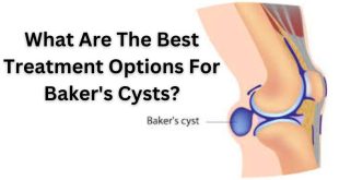 bakers cysts